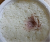 즉석밥 또 곰팡이 발생… 안전성 문제 심각