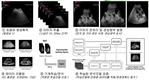 인공지능 기반 초음파 영상 분석으로 어미돼지 임신 진단