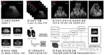 인공지능 기반 초음파 영상 분석으로 어미돼지 임신 진단