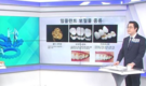 임플란트, 치과 선택시 비용보다 중요한 정확한 진단·맞춤 계획
